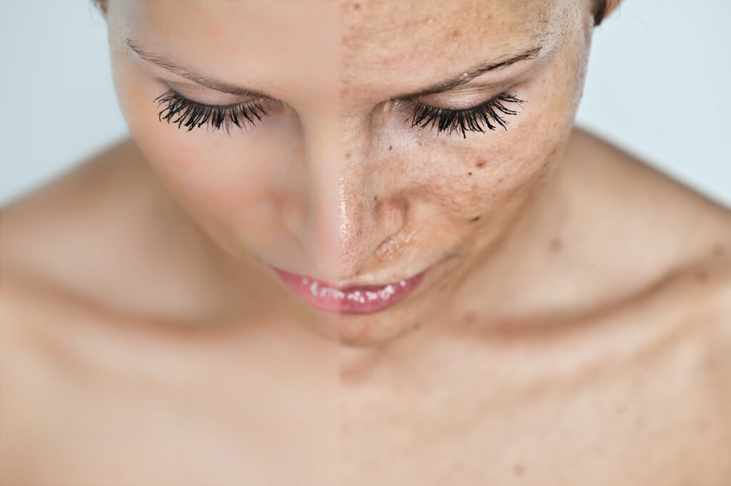 Natural Ways to Protect Your Skin from Photoaging